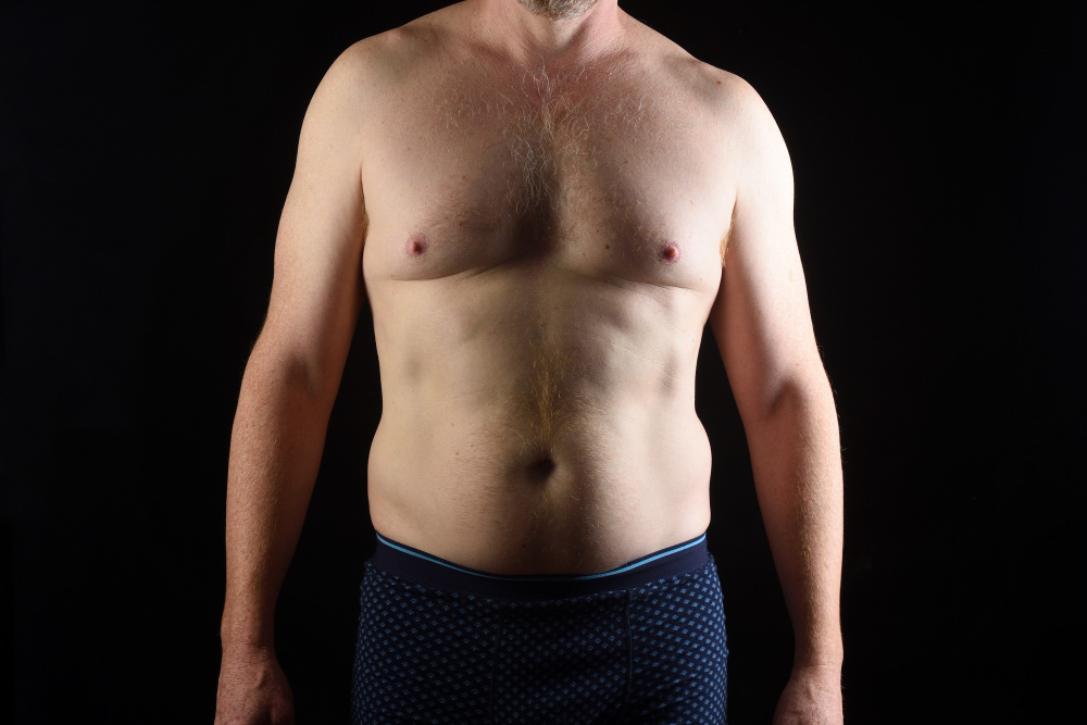 Breast Augmentation